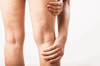 筋肉痛　来ない　筋トレ